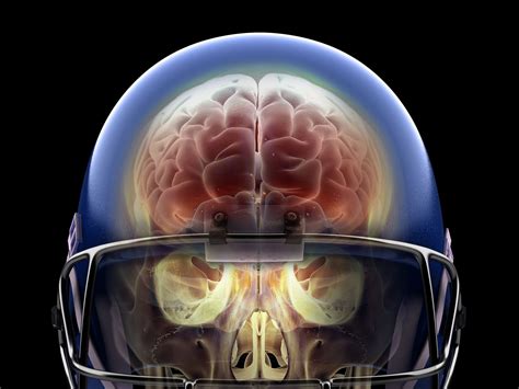 football concussion brain injury syndrome