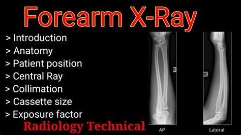 Forearm X Ray Positioning