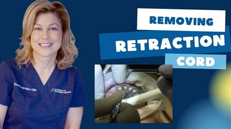 Forgot To Remove Retraction Cord