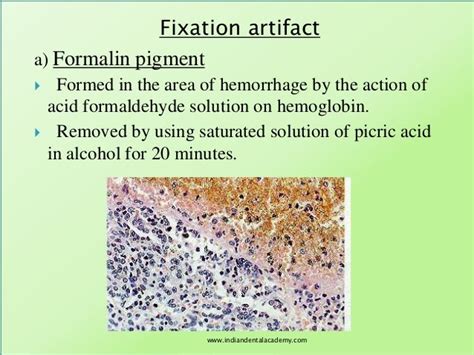 Formalin Fixation Artifacts