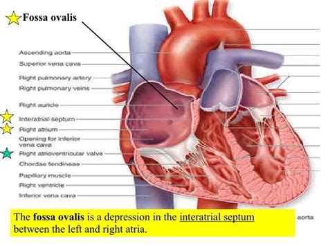 Understanding Fossa Ovalis Heart: Anatomy and Clinical Significance