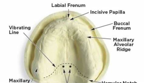 Fovea Palatini Anatomy 26.posterior Palatal Seal