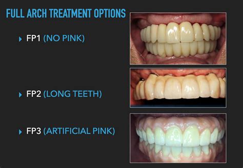 3 is the magic number Blog Ceramic Designs Lab