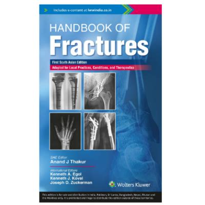 fracture handbook