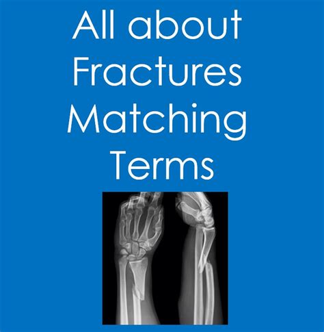 Fracture Match Definition