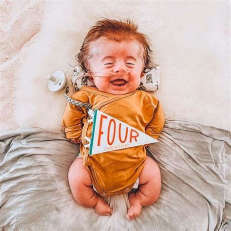 fragile bones in babies