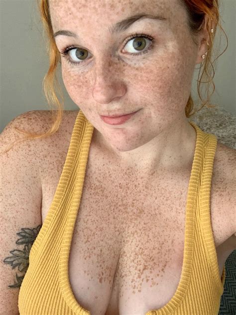 freckled tits