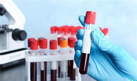Blood Drug Tests