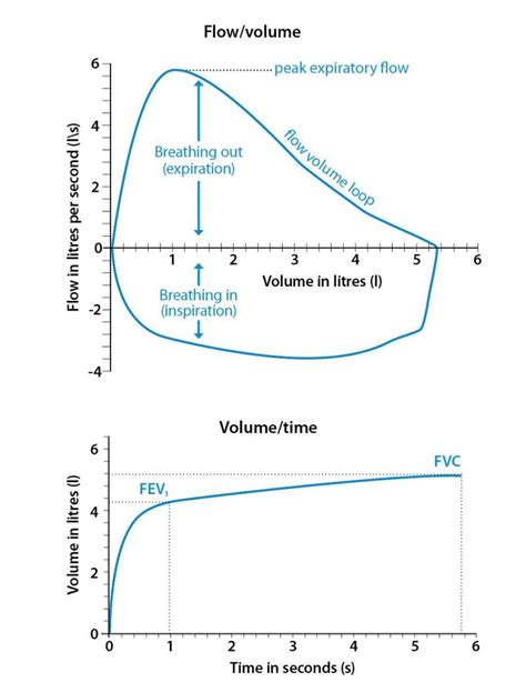 Frequency Of Spirometry Testing Copd