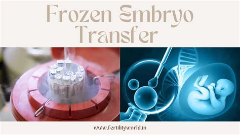 Frozen Embryo Transfer Edd