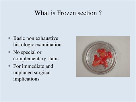 frozen section adalah