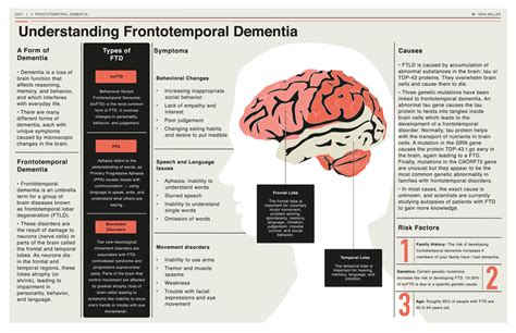 ftd does not affect memory