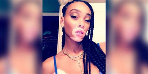 fun facts about winnie harlow