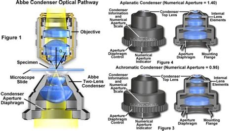 Function Of Condenser Lens In Electron Microscope