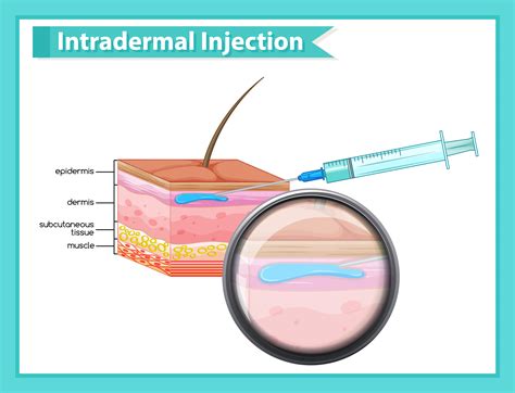 Function Of Intradermal Injection