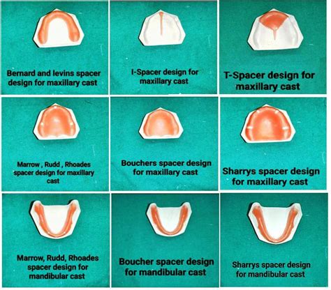 Function Of Spacer In Complete Denture