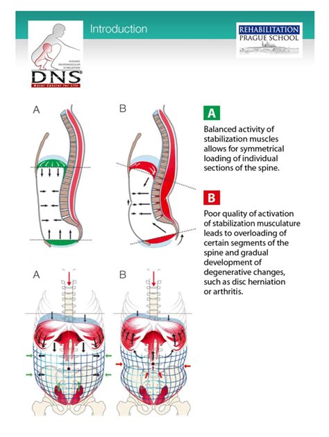 Functional Disc Stabilization