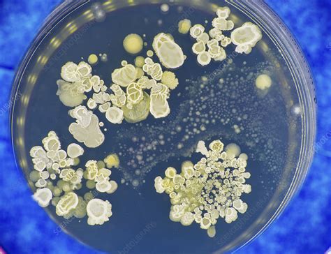 fungal colonies on agar plates