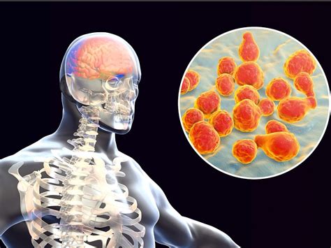 fungal meningitis of the skin