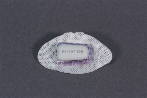 g5 sensor van dexcom