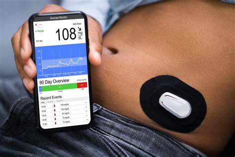 g6 dexcom application