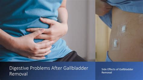 Understanding Gall Removal Side Effects: What You Need to Know After Surgery