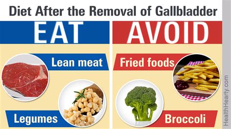 gallbladder removal diet