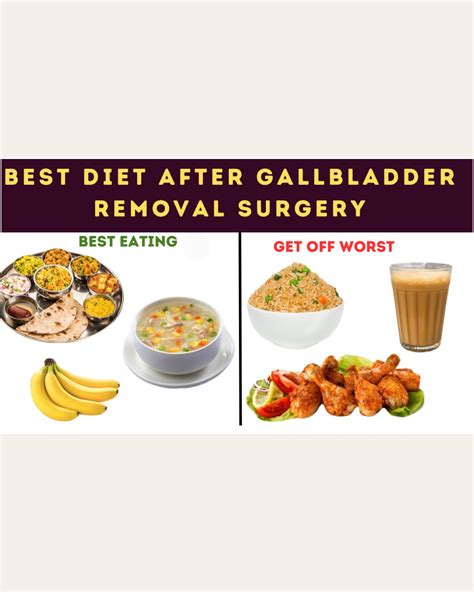 Recover Faster with a Post Gallbladder Removal Diet Plan