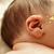 gambar benjolan di belakang telinga bayi