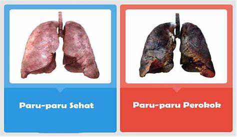 Adultos mayores - Longevitta - EPOC: cuando los pulmones se quedan sin aire