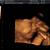 gambar scan bayi lelaki