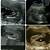 gambar scan jantina bayi perempuan