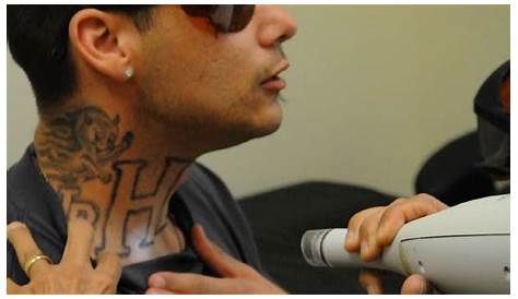 Gang Tattoo Removal Program California Today Starting Over With The Help Of