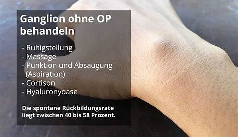 Ganglionentfernung | Orthopäde Wien - Dr. Hüthmair
