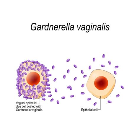 gardnerella vaginalis icd 10
