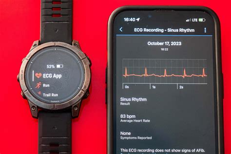 garmin venu 3 ecg