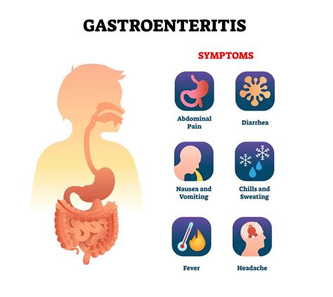 gastroenteritis due to norovirus