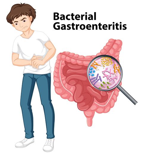 gastroenteritis viral or bacterial