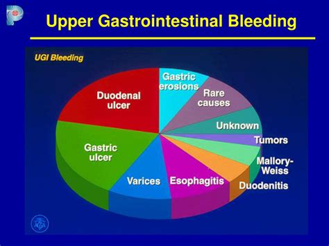 Upper Gastrointestinal Bleeding: Causes, Symptoms, and Treatment Options