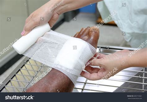 Gauze Chronic Wounds