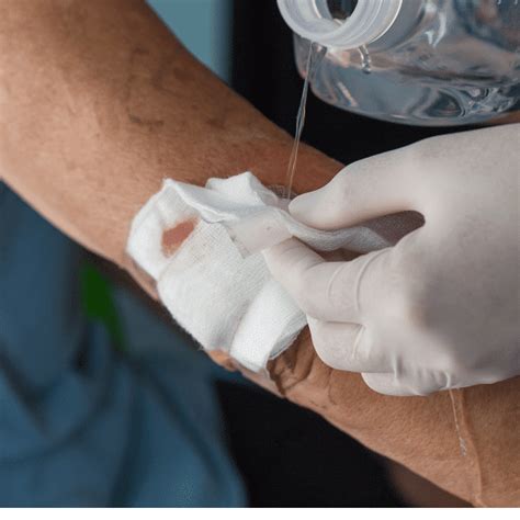 Gauze Version Meaning