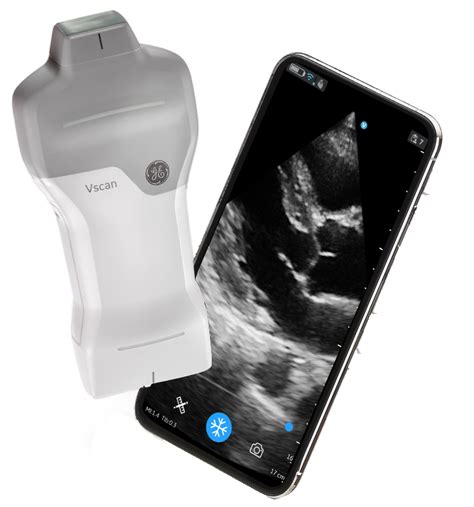 ge healthcare portable ultrasound
