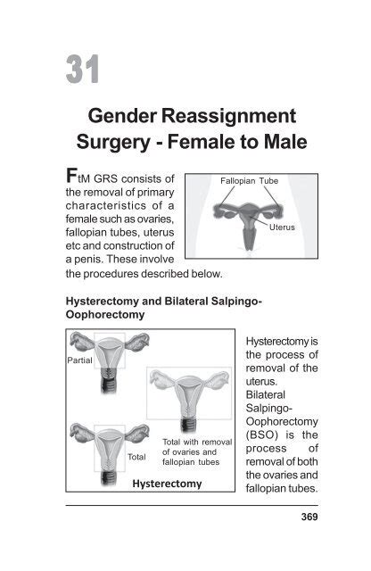 Gender Reassignment Surgery Diagnosis Codes