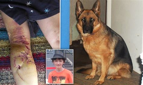 german shepherd bite marks