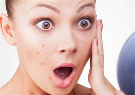 HOW TO GET RID OF ACNE? BEST SPOT TREATMENT (WORKS) OILY