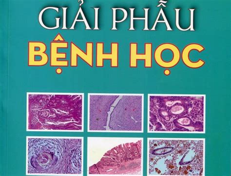 giải phẫu bệnh y hà nội