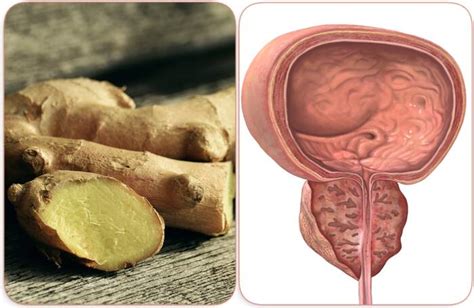 Ginger Is Good For Prostate