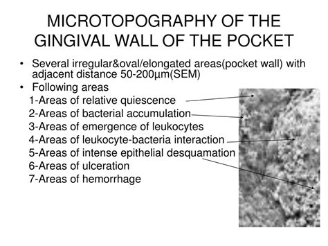 Gingival Wall
