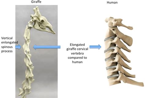 Giraffe Neck Bones Vs Human