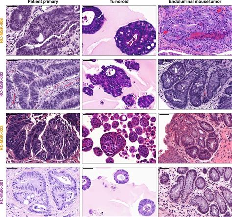 Glandular Architecture Definition